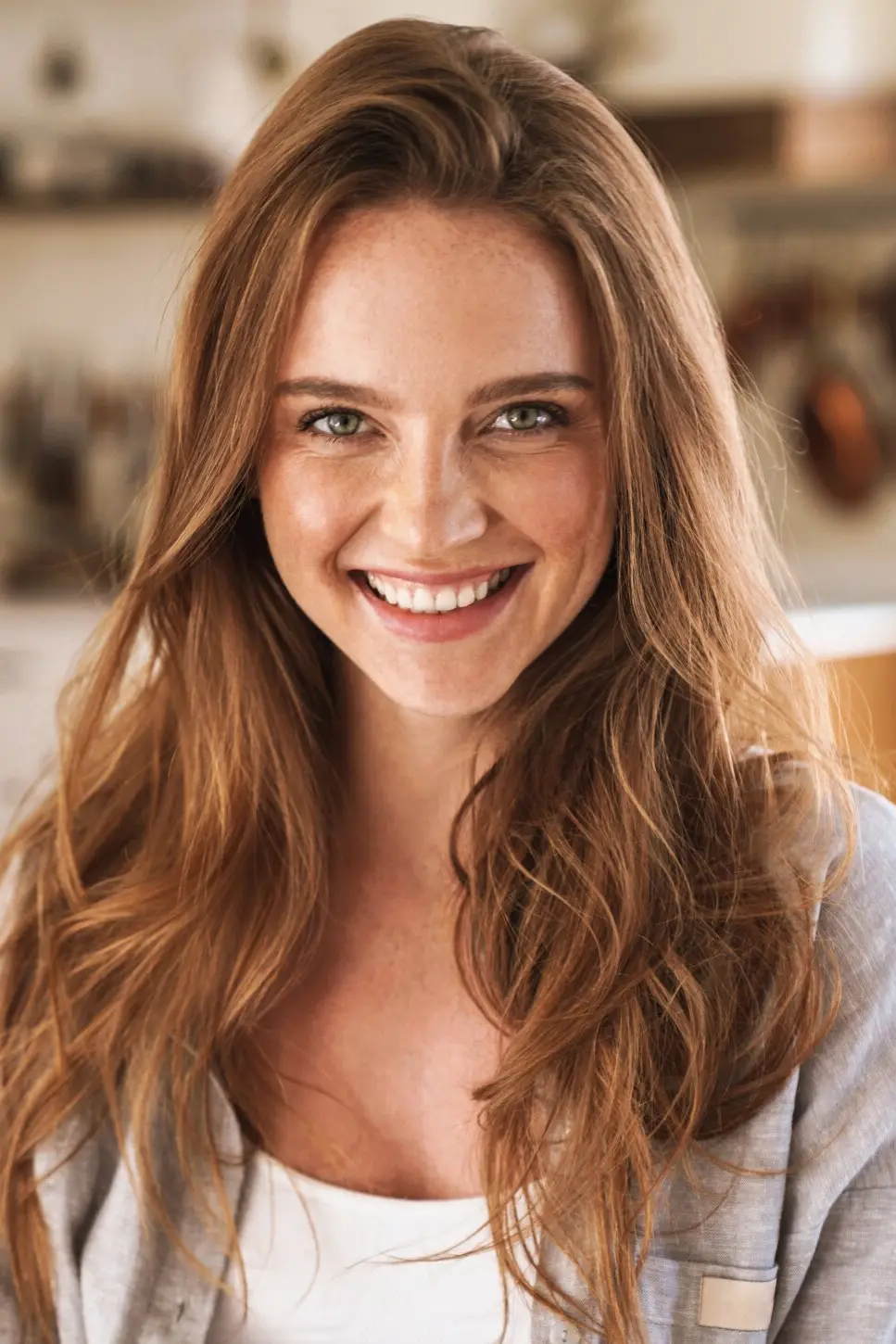 Dental Lumineers at Irvine Smile Design
