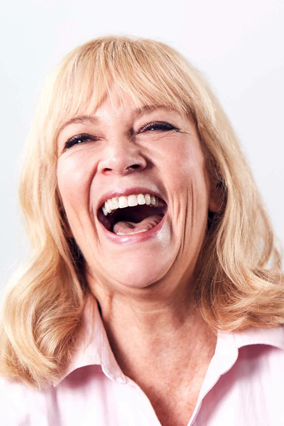 Same Day Dental Implants at Irvine Smile Design