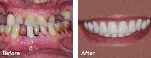 before-after-001
