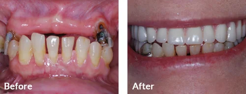 before-after-003