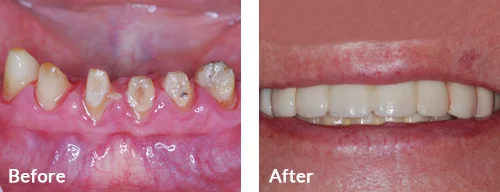 before-after-004