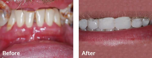 before-after-005