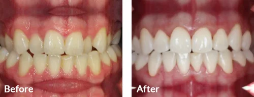 before-after-009