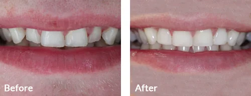 before-after-013