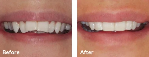 before-after-015