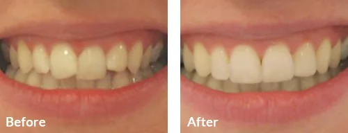 before-after-017